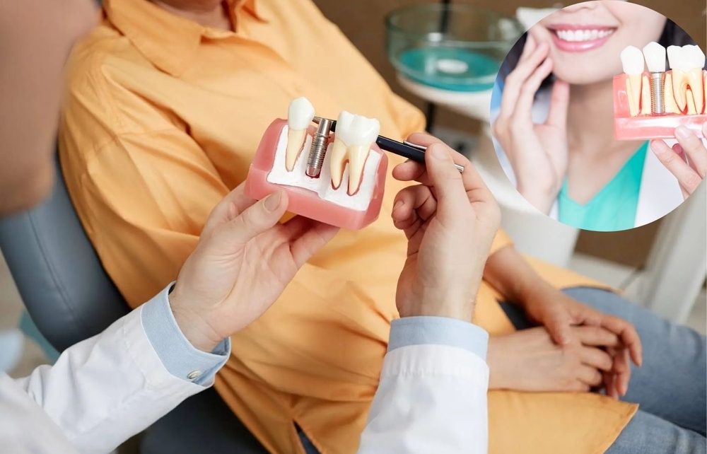 Dental Implants Are the Gold Standard in Tooth Replacement.jpg